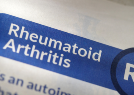Rheumatoid Arthritis