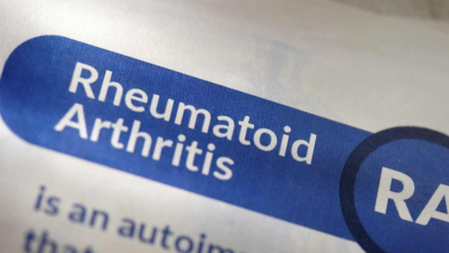 Rheumatoid Arthritis