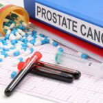 Prostate Cancer